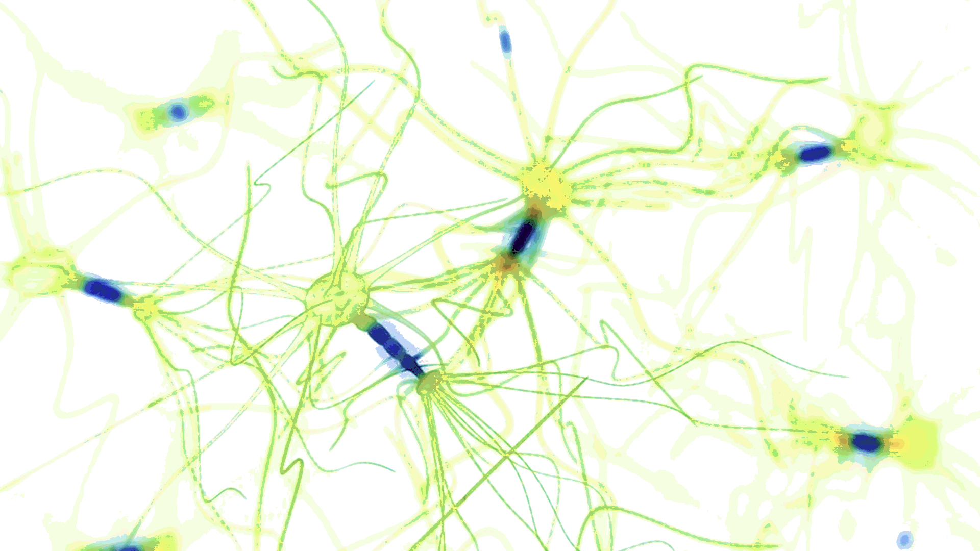 neuron neuron